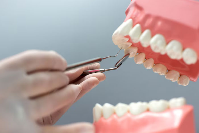 DENTAL-IMPLANT