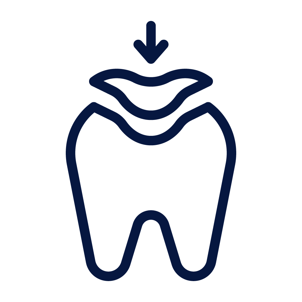 ROOT CANAL TREATMENT